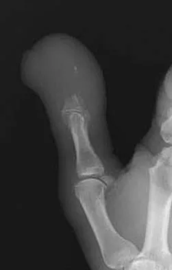 General Orthopedics Board Review 2026: High-Yield MCQs (Set 2) - Figure 84