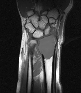 General Orthopedics Board Review 2026: High-Yield MCQs (Set 2) - Figure 99