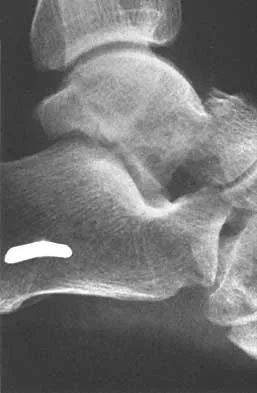 General Orthopedics Board Review 2026: High-Yield MCQs (Set 20) - Figure 2