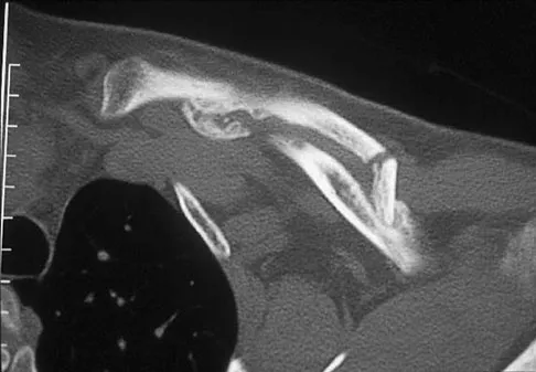 General Orthopedics Board Review 2026: High-Yield MCQs (Set 20) - Figure 22