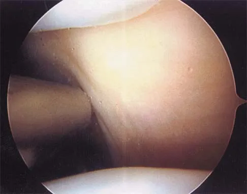 General Orthopedics Board Review 2026: High-Yield MCQs (Set 20) - Figure 25