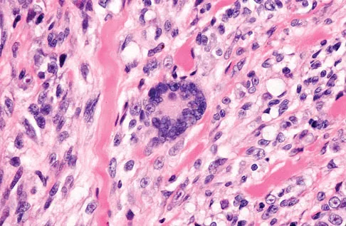 General Orthopedics Board Review 2026: High-Yield MCQs (Set 20) - Figure 29