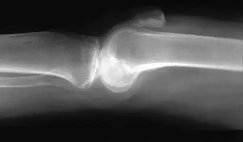 General Orthopedics Board Review 2026: High-Yield MCQs (Set 20) - Figure 31