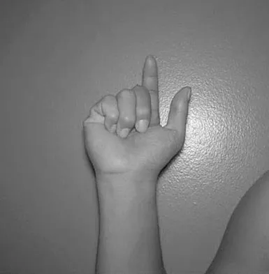 General Orthopedics Board Review 2026: High-Yield MCQs (Set 20) - Figure 35