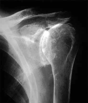 General Orthopedics Board Review 2026: High-Yield MCQs (Set 20) - Figure 44