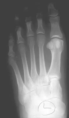 General Orthopedics Board Review 2026: High-Yield MCQs (Set 20) - Figure 49