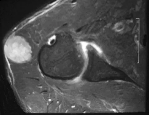 General Orthopedics Board Review 2026: High-Yield MCQs (Set 20) - Figure 56