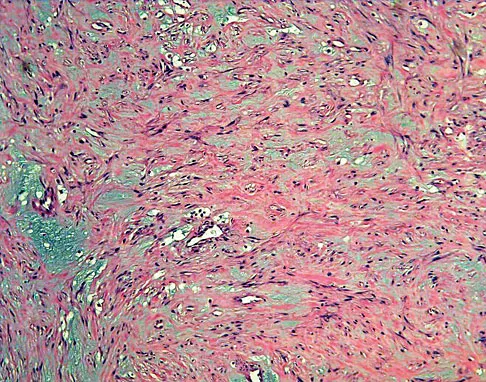 General Orthopedics Board Review 2026: High-Yield MCQs (Set 20) - Figure 57