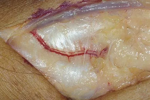 General Orthopedics Board Review 2026: High-Yield MCQs (Set 20) - Figure 61