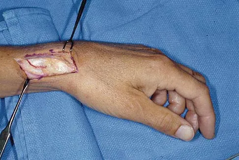 General Orthopedics Board Review 2026: High-Yield MCQs (Set 20) - Figure 62