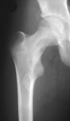 General Orthopedics Board Review 2026: High-Yield MCQs (Set 20) - Figure 65