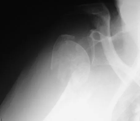 General Orthopedics Board Review 2026: High-Yield MCQs (Set 20) - Figure 66