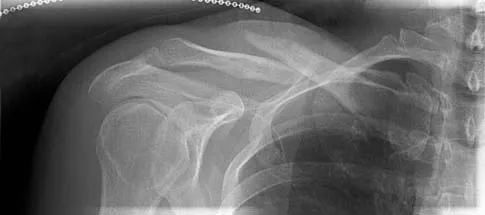 General Orthopedics Board Review 2026: High-Yield MCQs (Set 20) - Figure 68