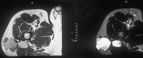 General Orthopedics Board Review 2026: High-Yield MCQs (Set 20) - Figure 74