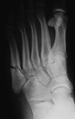 General Orthopedics Board Review 2026: High-Yield MCQs (Set 20) - Figure 78