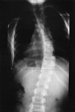General Orthopedics Board Review 2026: High-Yield MCQs (Set 20) - Figure 80