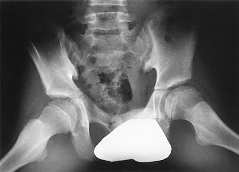 General Orthopedics Board Review 2026: High-Yield MCQs (Set 20) - Figure 83