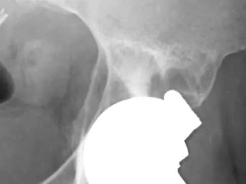 General Orthopedics Board Review 2026: High-Yield MCQs (Set 20) - Figure 86