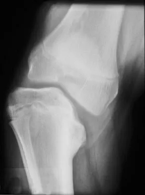 General Orthopedics Board Review 2026: High-Yield MCQs (Set 20) - Figure 88