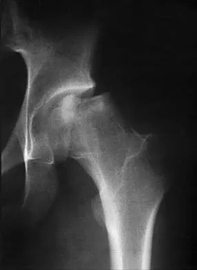 General Orthopedics Board Review 2026: High-Yield MCQs (Set 20) - Figure 9