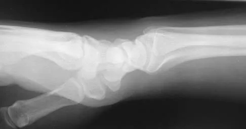 General Orthopedics 2026 Practice Questions: Set 3 (Solved) - Figure 10