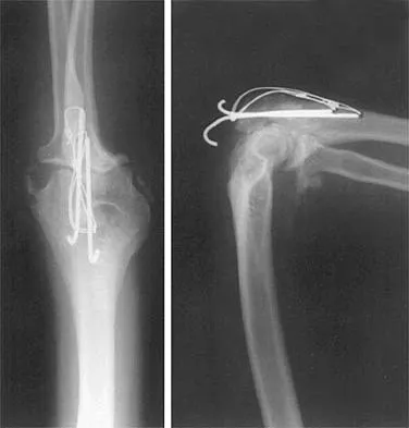 General Orthopedics 2026 Practice Questions: Set 3 (Solved) - Figure 100