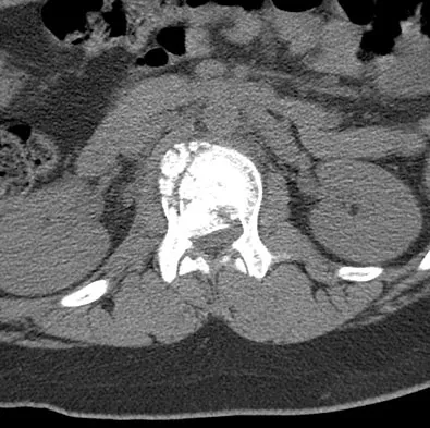 General Orthopedics 2026 Practice Questions: Set 3 (Solved) - Figure 103