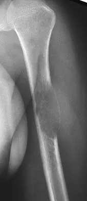 Click to enlarge General Orthopedics 2026 Practice Questions: Set 3 (Solved) - Figure 106