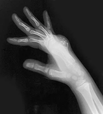 General Orthopedics 2026 Practice Questions: Set 3 (Solved) - Figure 110