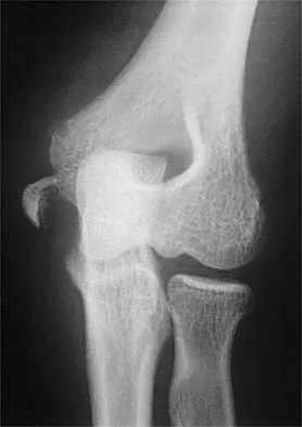 General Orthopedics 2026 Practice Questions: Set 3 (Solved) - Figure 112