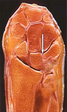 General Orthopedics 2026 Practice Questions: Set 3 (Solved) - Figure 116