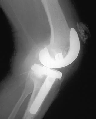 General Orthopedics 2026 Practice Questions: Set 3 (Solved) - Figure 117