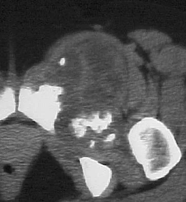 General Orthopedics 2026 Practice Questions: Set 3 (Solved) - Figure 121