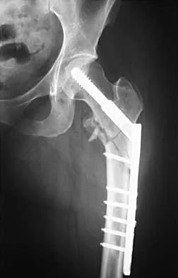 General Orthopedics 2026 Practice Questions: Set 3 (Solved) - Figure 14