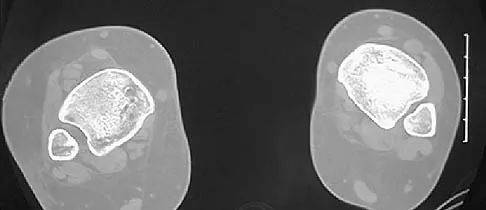 General Orthopedics 2026 Practice Questions: Set 3 (Solved) - Figure 17