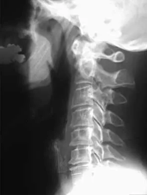 General Orthopedics 2026 Practice Questions: Set 3 (Solved) - Figure 22