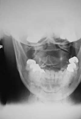 General Orthopedics 2026 Practice Questions: Set 3 (Solved) - Figure 23