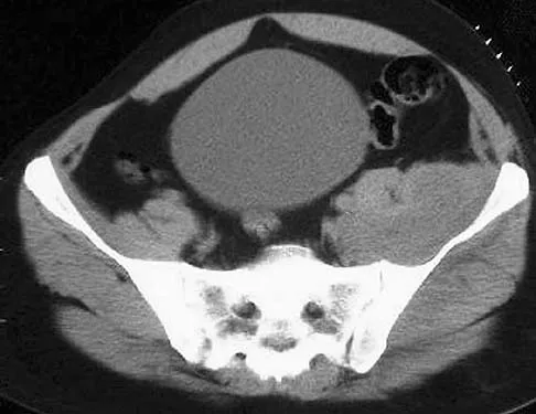 General Orthopedics 2026 Practice Questions: Set 3 (Solved) - Figure 26