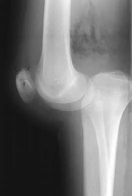 General Orthopedics 2026 Practice Questions: Set 3 (Solved) - Figure 29