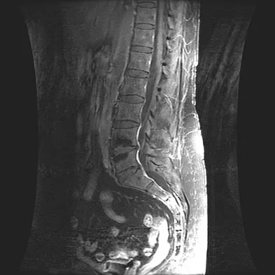 General Orthopedics 2026 Practice Questions: Set 3 (Solved) - Figure 32