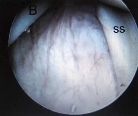 General Orthopedics 2026 Practice Questions: Set 3 (Solved) - Figure 33