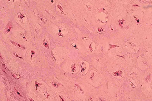General Orthopedics 2026 Practice Questions: Set 3 (Solved) - Figure 36