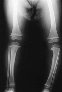 General Orthopedics 2026 Practice Questions: Set 3 (Solved) - Figure 37