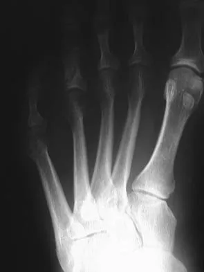 General Orthopedics 2026 Practice Questions: Set 3 (Solved) - Figure 4