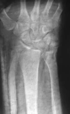 General Orthopedics 2026 Practice Questions: Set 3 (Solved) - Figure 40