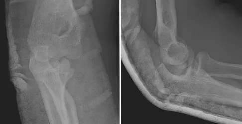 General Orthopedics 2026 Practice Questions: Set 3 (Solved) - Figure 45