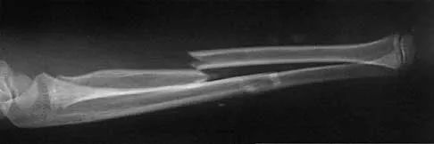 General Orthopedics 2026 Practice Questions: Set 3 (Solved) - Figure 47