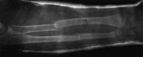 General Orthopedics 2026 Practice Questions: Set 3 (Solved) - Figure 48