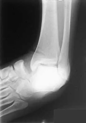 General Orthopedics 2026 Practice Questions: Set 3 (Solved) - Figure 5