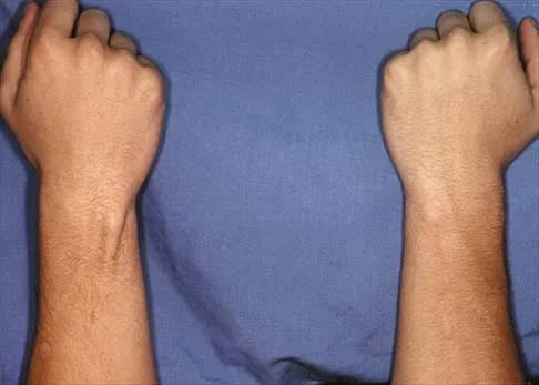 General Orthopedics 2026 Practice Questions: Set 3 (Solved) - Figure 58